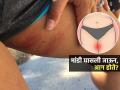 उन्हाळ्यात मांड्या घासल्या जातात-चालायला त्रास होतो? ८ उपाय करा, मांड्यांची आग होणं थांबेल - Marathi News | Thigh Chafing Inner Thigh Chafing And How Do I Treat It : How To Deal With Inner Thigh Chafing | Latest sakhi Photos at Lokmat.com