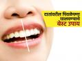 दातांचा पिवळेपणा दूर करणारे ३ घरगुती उपाय, चारचौघात हसताना लाजू नका-हसा मनमोकळं.. - Marathi News | How to get rid of yellow teeth top 3 home remedies for yellow teeth | Latest sakhi News at Lokmat.com