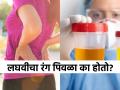 सकाळी उठल्याउठल्या पिवळ्या रंगाची लघवी होत असेल तर सावधान! तब्येत सांगतेय, बिघाड मोठाच.. - Marathi News | What is the sign of dark yellow urine in the morning, know causes | Latest sakhi News at Lokmat.com