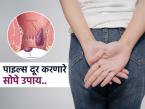 पाइल्सचा त्रास कमी करणारे सोपे घरगुती उपाय; सर्जरीची वेळ येण्यापूर्वी बदला ‘या’ सवयी - Marathi News | Harvard doctor tells easy home remedies to get rid piles | Latest sakhi Photos at Lokmat.com पाइल्सचा त्रास कमी करणारे सोपे घरगुती उपाय; सर्जरीची वेळ येण्यापूर्वी बदला ‘या’ सवयी - Marathi News | Harvard doctor tells easy home remedies to get rid piles | Latest sakhi Photos at Lokmat.com