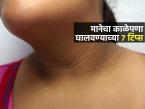 चेहरा गोरा पण मान काळवंडलीये? ७ टिप्स, मानेचे काळे थर दूर होतील-सुंदर दिसेल मान - Marathi News | How To Get Rid Of Dark Neck : How To Remove Neck Darkness | Latest sakhi Photos at Lokmat.com चेहरा गोरा पण मान काळवंडलीये? ७ टिप्स, मानेचे काळे थर दूर होतील-सुंदर दिसेल मान - Marathi News | How To Get Rid Of Dark Neck : How To Remove Neck Darkness | Latest sakhi Photos at Lokmat.com