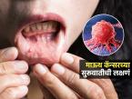 माऊथ कॅन्सरच्या सुरूवाची ७ लक्षणं; तोंड आलंय म्हणून दुर्लक्ष करण्याआधी लक्षणं ओळखा - Marathi News | 7 Early signs of mouth cancer : Signs Of Mouth Cancer Mouth Cancer Symptoms | Latest sakhi Photos at Lokmat.com माऊथ कॅन्सरच्या सुरूवाची ७ लक्षणं; तोंड आलंय म्हणून दुर्लक्ष करण्याआधी लक्षणं ओळखा - Marathi News | 7 Early signs of mouth cancer : Signs Of Mouth Cancer Mouth Cancer Symptoms | Latest sakhi Photos at Lokmat.com