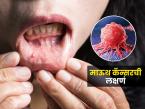 माऊथ कॅन्सरची सुरुवातीची ७ लक्षणं; सतत तोंड येतं म्हणत दुर्लक्ष करणंही पडू शकतं महागात - Marathi News | 7 Early signs of mouth cancer : Signs Of Mouth Cancer Mouth Cancer Symptoms | Latest sakhi Photos at Lokmat.com माऊथ कॅन्सरची सुरुवातीची ७ लक्षणं; सतत तोंड येतं म्हणत दुर्लक्ष करणंही पडू शकतं महागात - Marathi News | 7 Early signs of mouth cancer : Signs Of Mouth Cancer Mouth Cancer Symptoms | Latest sakhi Photos at Lokmat.com