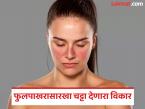हा ब्लश नाही, महिलांना होणारा गंभीर आजार आहे; लुपस विकार ज्याने गर्भपातही होऊ शकतो - Marathi News | This is not a blush, it is a serious disease that affects women; Lupus disorder which can also cause miscarriage | Latest health Photos at Lokmat.com हा ब्लश नाही, महिलांना होणारा गंभीर आजार आहे; लुपस विकार ज्याने गर्भपातही होऊ शकतो - Marathi News | This is not a blush, it is a serious disease that affects women; Lupus disorder which can also cause miscarriage | Latest health Photos at Lokmat.com