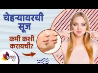 चेहऱ्यावरील सूज कशी कमी करावी | How To Reduce Face bloating | Lokmat Sakhi