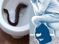 अरे देवा! टॉयलेट सीटवर बसताच सापाने व्यक्तीच्या प्रायव्हेट पार्टला मारला दंश आणि मग..... - Marathi News | A man went to the toilet and got bitten on private part by pet snake of his neighbour | Latest jarahatke Photos at Lokmat.com