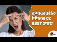 कपाळावरील पिंपल्स वर Best उपाय | How to get rid of Pimples on Forehead? Lokmat Sakhi