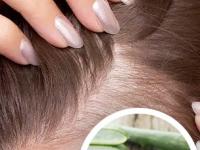 केस एवढे गळतात की टक्कल पडण्याचीच वाटते भीती; 'हा' घरगुती उपाय ठरेल रामबाण - Marathi News | how to use aloe vera for hair growth | Latest sakhi Photos at Lokmat.com