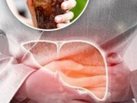 लिव्हर खराब करणारे हे पदार्थ खाणं कायमचं करा बंद, फक्त दारुनेच लिव्हर खराब होतं असं नाही.. - Marathi News | Liver Health : Which foods are most harmful for liver | Latest sakhi Photos at Lokmat.com