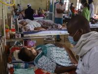 Omicron Scare! Will black fungus return again amid third wave of COVID-19 - News | Omicron Scare! Will black fungus return again amid third wave of COVID-19 | Latest health Photos at Lokmattimes.com Omicron Scare! Will black fungus return again amid third wave of COVID-19 - News | Omicron Scare! Will black fungus return again amid third wave of COVID-19 | Latest health Photos at Lokmattimes.com