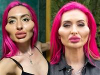 बोंबला! सुंदर दिसण्यासाठी केला जुगाड पण महिलेचा चेहरा बिघडला, वेदनादायी ट्रिटमेंटसाठी घालवले लाखों रूपये - Marathi News | People make fun of instagram model Anastasia Pokreshchuk worlds biggest cheeks | Latest jarahatke Photos at Lokmat.com