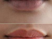 ओठांवर खूप भेगा दिसतात- कोरडे पडून काळवंडले? घ्या उपाय- ओठ होतील मऊ, गुलाबी - Marathi News | home remedies for naturally pink lips, how to get rid of dark and dry lips, home hacks for soft pink lips | Latest sakhi Photos at Lokmat.com