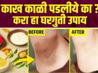 काळवंडलेल्या अंडरआर्म्ससाठी करा हा घरगुती उपाय | How to Get Rid of Dark Underarms | Dark Underarms