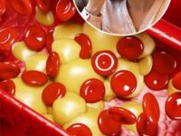 पथ्यं पाळूनही कोलेस्टेरॉल वाढलेलं असतं? डॉक्टर सांगतात ५ पदार्थ रोज खा- कोलेस्टेरॉल राहील कंट्रोलमध्ये - Marathi News | how to reduce cholesterol, best 5 ingredients in kitchen that helps to reduce LDL cholesterol, super food to reduce bad cholesterol | Latest sakhi Photos at Lokmat.com