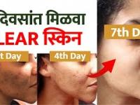 क्लिअर स्किनसाठी करा हे घरगुती उपाय | 7 Days Clear Skin Challenge | How To Get Clear Skin Naturally