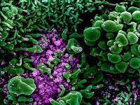 CoronaVirus News: लोकांना संक्रमित करण्यासाठी अमेरिका तयार करतोय नवा कोरोना व्हायरस! - Marathi News | CoronaVirus News America government manufacture coronavirus strain to use in human challenge trials | Latest international Photos at Lokmat.com