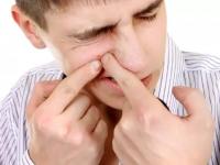 SMART TIPS : ​पुरुषांनो, चेहऱ्यावरील ‘ब्लॅकहेड ’असे करा दूर ! - Marathi News | SMART TIPS: Men, make the 'Blackhead' on the face! | Latest beauty Photos at Lokmat.com