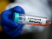 CoronaVirus News: कोरोनापासून बचाव करण्यासाठी संशोधकांची 'वेगळीच' शक्कल; लस येईपर्यंत होणार संरक्षण - Marathi News | CoronaVirus three Indian Companies Developing Covid 19 Antibody Drugs | Latest health Photos at Lokmat.com