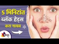 ५ मिनिटात ब्लॅक हेड्स करा गायब | Remove Blackheads in Just 5 Minutes | Lokmat Sakhi