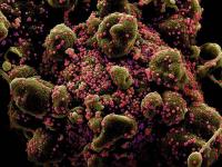 Coronavirus : चीनच्या टॉप एक्सपर्ट म्हणाल्या, '20 वर्षांपर्यंत जिवंत राहू शकतो कोरोना व्हायरस', पण मग... - Marathi News | Coronavirus survive freezing temperature 20 years Chinese top epidemiologist says | Latest health Photos at Lokmat.com