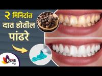 पिवळे दात चमकदार बनवायचे आहेत? तर करा 'हे' घरगुती उपाय | How to Get Rid of Yellow Teeth at Home