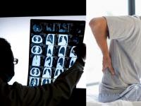 कंबरदुखीची समस्या घेऊन डॉक्टरकडे गेला, सीटी स्कॅनमधे जे दिसलं ते पाहून डॉक्टर चक्रावले! - Marathi News | Brazil man visits doctor for lower back pain discovers he has three kidneys api | Latest jarahatke Photos at Lokmat.com