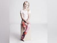 छोट्या-छोट्या दुःख-संकटांनी खचून जाता?... मग, हे फोटो वेगळंच बळ देऊन जातील! - Marathi News | Limb difference awareness photoshoot | Latest social-viral Photos at Lokmat.com