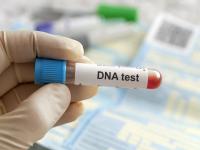 अजबच! एकाच आईच्या जुळ्या मुली, पण दोघींचेही वडील वेगवेगळे; DNA रिपोर्टमधून खळबळजनक खुलासा - Marathi News | Twin daughters from the same mother, but both have different fathers; Sensational revelation from DNA report | Latest jarahatke News at Lokmat.com