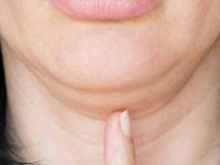 ७ दिवसांत 'डबल चिन' होईल गायब! १० मिनिटं करा 'हे' फेस योगा- जिमशिवाय मिळेल परफेक्ट 'जॉलाईन'- दिसाल तरुण - Marathi News | How to get a sharp jawline in 7 days Best face yoga for double chin Facial exercises for beginners Get rid of face fat without gym Face slimming exercises at home | Latest sakhi Photos at Lokmat.com