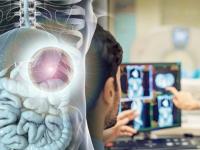 Tumor operation girl : अनेक दिवसांपासून १२ वर्षीय चिमुरडीच्या पोटात दुखायचं; डॉक्टरांनी पोटातून काढला २ फुटबॉल एवढा ट्यूमर - Marathi News | Tumor operation girl stomach two football size doctor sir ganga ram hospital | Latest jarahatke Photos at Lokmat.com