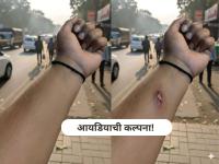 बाबो! ना पडला, ना लागलं... AI ने जखम दाखवून कर्मचाऱ्याने घेतली सुटी, HR ला काढलं वेड्यात - Marathi News | ai fake hand injury employee tricks hr takes leave without detection | Latest social-viral News at Lokmat.com