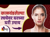 काळवंडलेल्या त्वचेवर करा घरच्या घरी उपाय | How To Get Rid Of Sun Tan | Body Tanning | Lokmat Sakhi