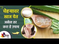 चेहऱ्यावर खाज येत असेल तर करा हे उपाय | 3 Best Home Remedies for Itchy Skin | Itchy Skin Remedies