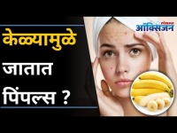 केळ्यामुळे जातात पिंपल्स? 5 Benefits of Banana for Skin and Hair I Remove Pimples | Lokmat Oxygen