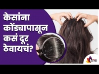 केसांमधील कोंडा कमी करण्यासाठी काही सोपे उपाय | Dandruff Problem? Know How To Get Rid Of It | Hair