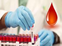 Golden Blood: जगात केवळ ५० जणांकडेच ‘गोल्डन ब्लड’; फायदे-तोटे ऐकून तुम्हीही व्हाल हैराण - Marathi News | Only 50 people in the world have 'Golden Blood'; What Is Their Side Effects And Benefits | Latest health Photos at Lokmat.com