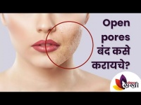 ओपन पोर्स बंद कसे करायचे? How To Get Rid Of Open Pores? Know Easy Home Remedies | Lokmat Sakhi