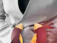 ५ लक्षणं सांगतात किडनीचं आरोग्य बिघडू लागलंय! वेळेत ‘हे’ बदल वाचवतील किडनी - Marathi News | 5 signs that shows about kidney failure, 5 changes in body that shows your kidneys are not functioning properly, 5 warning signs your kidneys are failing | Latest sakhi Photos at Lokmat.com