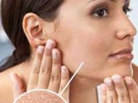 थंडीत चेहऱ्यावर शिंपडा 'हे' पाणी, त्वचा इतकी दिसेल तजेदार आणि हायड्रेटेड की जणू ब्यूटी क्वीन - Marathi News | how to keep skin hydrated in winter season, home hacks for dry skin, use of rose water for skin care, how to keep skin soft in winter season | Latest sakhi Photos at Lokmat.com