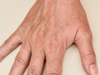 घरकाम करून हात खरखरीत झाले- काळवंडून गेले? फक्त १० मिनिटांचा उपाय- हात होतील मऊ - Marathi News | how to remove tanning and dead skin from hand, how to make palm soft, how to remove blackness from hands | Latest sakhi Photos at Lokmat.com