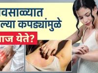 पावसाळ्यात ओल्या कपड्यांमुळे खाज येत | How To Treat Itchy Skin Rash Naturally | Itchy Skin Rashes