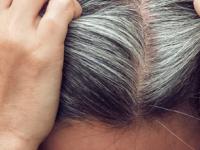 White Hair Solution : केस खूप पांढरे झालेत? आठवडभरात काळेभोर होतील केस, फक्त बटाट्याच्या सालीचा असा करा वापर - Marathi News | White Hair Solution : Potato peel for premature white hair problems solution home remedies vegetable | Latest sakhi Photos at Lokmat.com