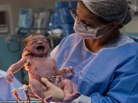 आता माझी सटकली...! नाळ कापताना बालिकेने असे काही पाहिले; डॉक्टरच शॉक झाले - Marathi News | Hilarious photos show the moment a newborn baby frowns at a doctor who tries to make her cry | Latest social-viral Photos at Lokmat.com