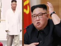 Kim Jong Un: किम जोंग उन पुन्हा आजारी! वजन घटलेले, शरीर थकलेले...नवे फोटो धक्कादायक - Marathi News | Kim Jong Un sick again! huge Weight loss, Photo viral; befuddles North Korea watchers | Latest international Photos at Lokmat.com