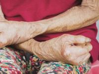 कुष्ठरोगाचे निदान झाले रे झाले की, रुग्णनाेंद बंधनकारक; सार्वजनिक आरोग्य विभागाचा निर्णय - Marathi News | Once diagnosed with leprosy registration is mandatory Public Health Department decision | Latest health News at Lokmat.com