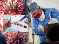 टेन्शन वाढलं! कोरोनानंतर आला जीवघेणा Marburg Virus; 'ही' 10 लक्षणं दिसताच व्हा सावध - Marathi News | what is marburg virus 10 symptoms treatment and prevention tips | Latest health Photos at Lokmat.com