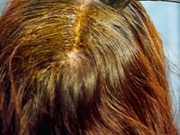 मेहंदी लावून केसांचं वाटोळं करणाऱ्या ७ चुका, केसांचा झाडू आणि केसगळती नको असेल तर.. - Marathi News | 7 mistakes that can ruin your hair after applying mehendi on scalp if you don't want frizzy hair and hair loss stop this mistake | Latest sakhi Photos at Lokmat.com