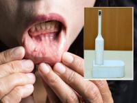 Oral cancer चे निदान टूथब्रशद्वारे लागणार, IIT Kanpur मध्ये बनवलेले डिव्हाईस लवकरच बाजारात येणार! - Marathi News | IIT Kanpur Develops oral cancer detection device ‘Munh Parikshak’ | Latest health Photos at Lokmat.com