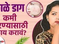 चेहऱ्यावरील काळे डाग जाण्यासाठी घरगुती उपाय | How To Remove Dark Spots | Dark Spots | Lokmat Sakhi