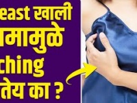 तुम्हाला घामामुळे रॅशेस येतात का | How to Get Rid of Rash Under Breast | Rash Under Breast |